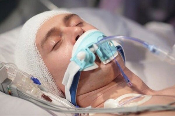 ضربه به سر ممکن است سلامت روده را مختل کند